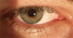 Auge2.gif